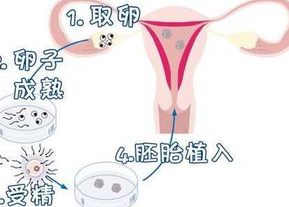 泰州比较好的第三代试管婴儿医院是哪家？费用及成功率详解